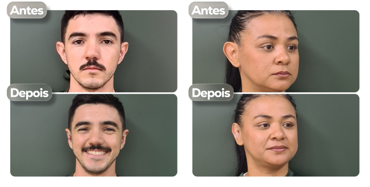 Resultados antes e depois